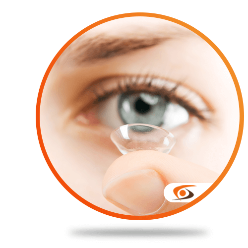 Toric Contact Lenses for Astigmatism