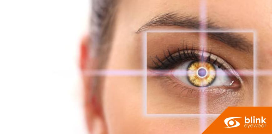 The Role Of Your Eye Doctor In LASIK Surgery Co-Management