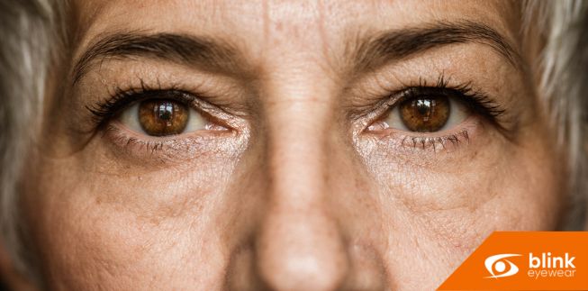 Understanding Presbyopia: The Challenge Of Aging Eyes