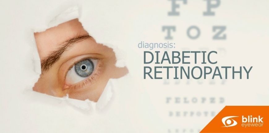 The Connection Between Diabetes and Eye Health: Why Diabetic Retinal Exams Are Crucial