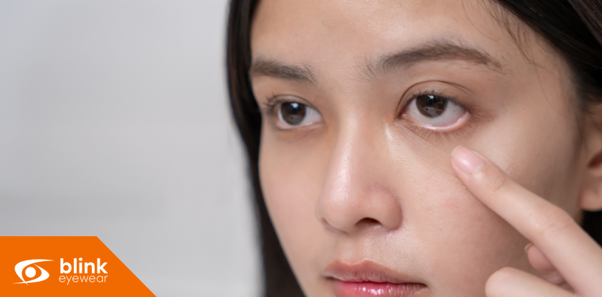 Dry Eye Awareness in Calgary: What Causes It and How to Treat It This Winter