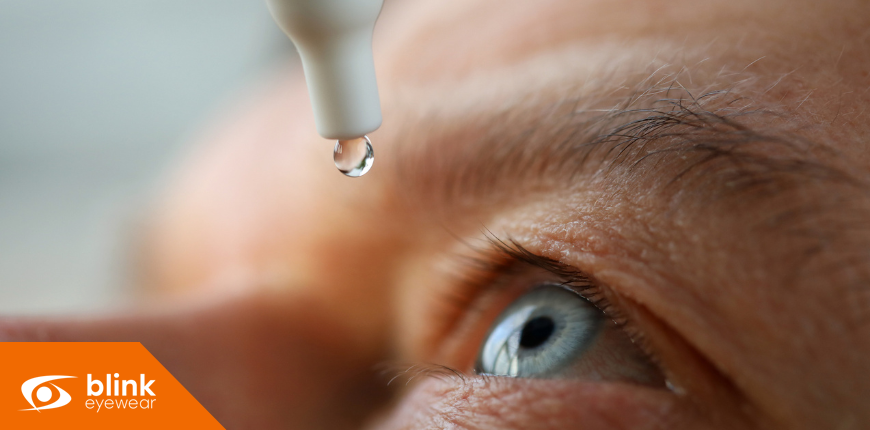 Winter Dry Eye Relief: How to Get Through Calgary’s Coldest Months